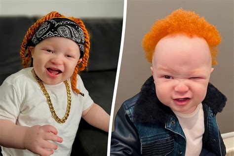 Black Mum Who Has Albino Baby With Ginger Hair Dyes Her Own So He