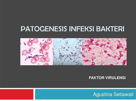 Ppt Patogenesis Infeksi Bakteri Powerpoint Presentation Free