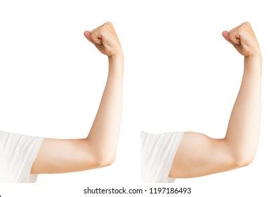 Mans Hand Muscles Before After Sports Stock Photo 1197186493 | Shutterstock