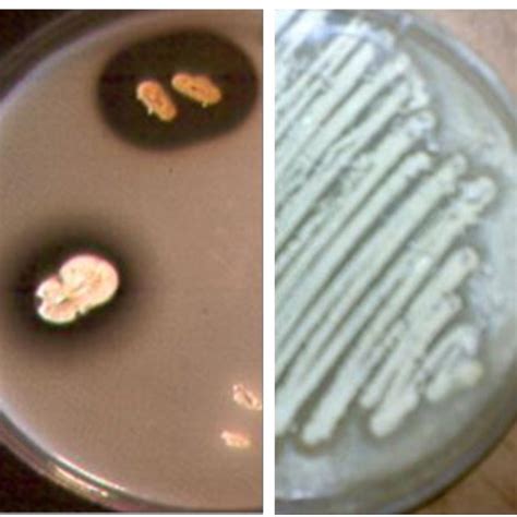 A Tributyrin Tsa Plate Showing Bacterium With Lipase Activity Clear Download Scientific