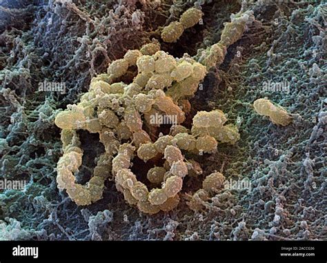 Streptococcus Mutans Farbige Scanning Electron Micrograph Sem Von