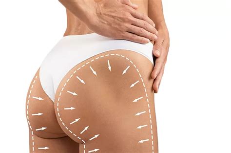 BBL Brazilian Butt Lift Tac Clinic