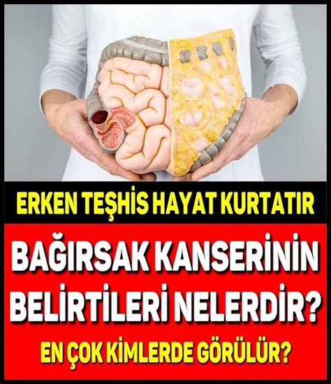 Bağırsak Kanserinin Belirtileri Nelerdir Erken Teşhis Hayat Kurtarır