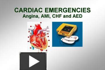 Ppt Cardiac Emergencies Angina Ami Chf And Aed Powerpoint