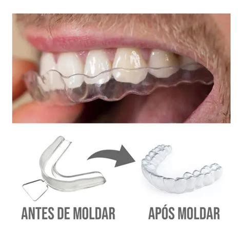 2 Aparelhos Anti Bruxismo Ranger De Dentes Mega Promoção Parcelamento