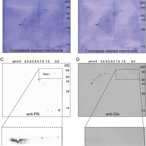 Pn Extracted From Fibrotic Human Lung Has The Pi Expected Of