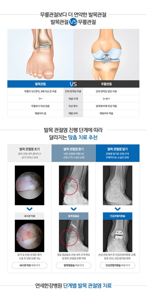 관절·척추·골절수술 연세한강병원 난치성 발발목 통증 발목관절염