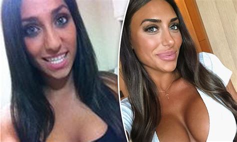 Love Island Australia Star Margarita Smith S Pre Surgery Photos Emerge