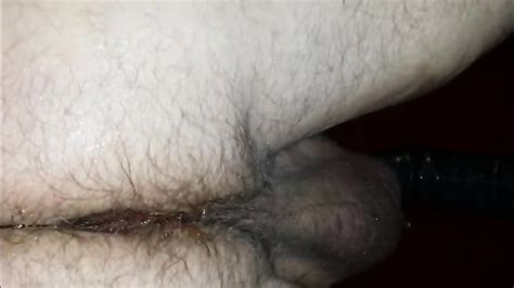 Anal Prostate Milking With Cumshot After The Milking