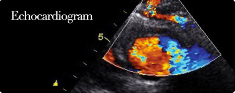 Echocardiography | Ruth Kam Heart & Arrhythmia Clinic