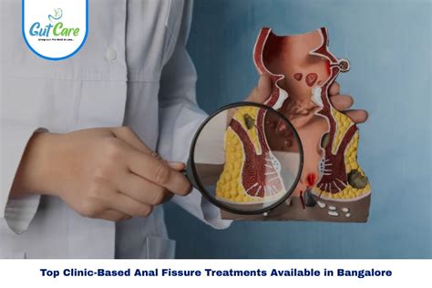 Best Anal Fissure Treatment That Works In Bangalore