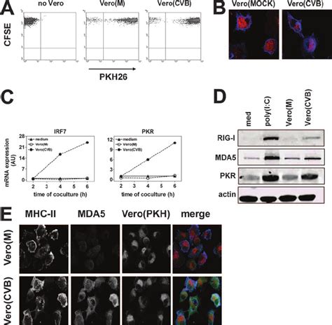 Phagocytosis Of Virus Infected Cells Increases The Expression Of Rig I