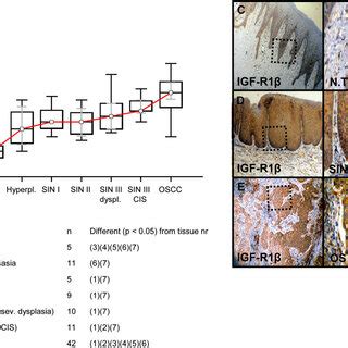 Immunohistochemical Analysis And Staining Of Glut In Normal Oral