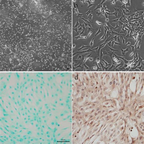 Isolation And Identification Of Chondrocytes The Chondrocytes Were