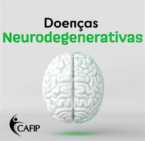 Doenças Neurodegenerativas Guia Saúde Cidades