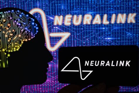 Neuralink De Elon Musk Implanta Con éxito Un Dispositivo Cerebral