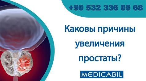 Blog | Каковы причины увеличения простаты?