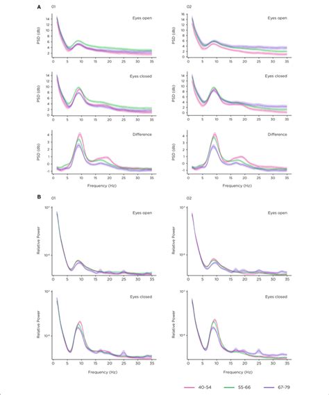 Resting State Task A Power Spectral Density Psd In Decibels Db