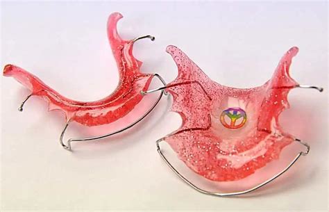 How Are Orthodontic Hawley Retainers Made Ask An