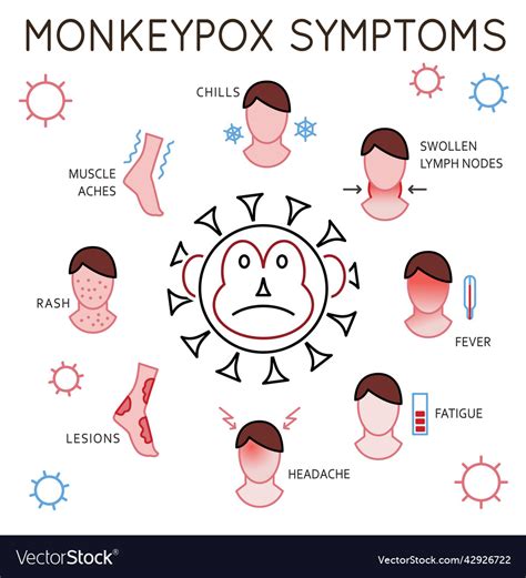 Main Monkeypox Virus Symptoms Editable Royalty Free Vector