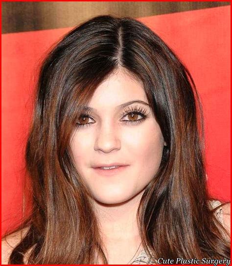 Kylie Jenner Plastic Surgery Transformation Celebrities Plastic Surgery