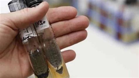 En Durango Suman Decesos Por Meningitis