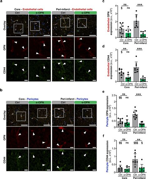 Anti Osteopontin Antibody Treatment Reduces Osteopontin And Cd