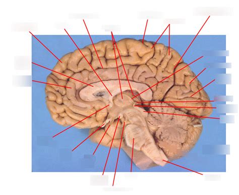 Neuroanatomy 13 Diagram Quizlet