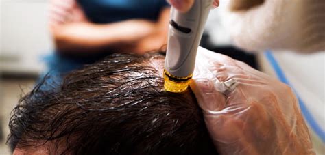 HydraFacial Keravive Scalp Treatment For Fuller Looking Hair