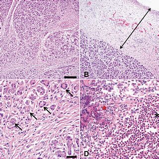 Histopathological Analysis Of The Pancreas Of A Diseased Tursiops