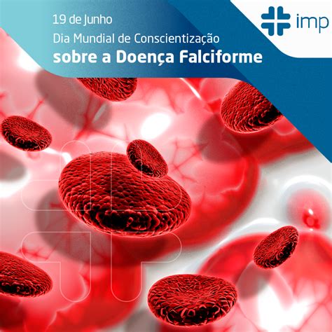 Dia Mundial De Conscientiza O Sobre A Doen A Falciforme Imp