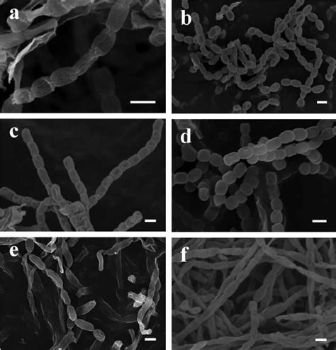 Spore Chain Morphology Of A Streptomyces Griseus Lac1 B