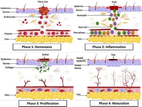 Four Different Stages Haemostasis Inflammation Proliferation And