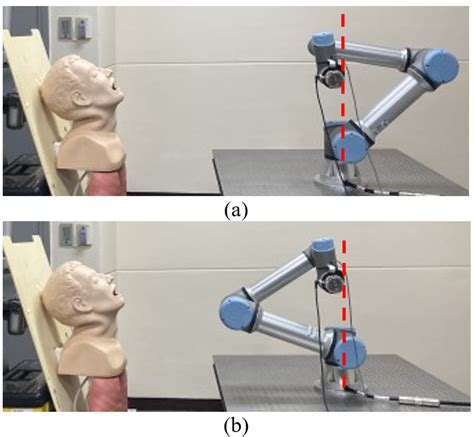 Comparison Of A Elbow Up Pose And B Elbow Down Pose Of The Robot