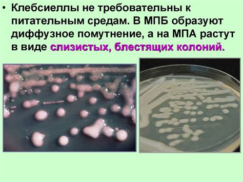 Санитарная микробиология - презентация онлайн