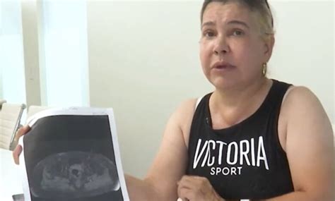 Mujer De Utah Lucha Por Su Vida Tras Inyectarse Biopol Meros La Neta Neta