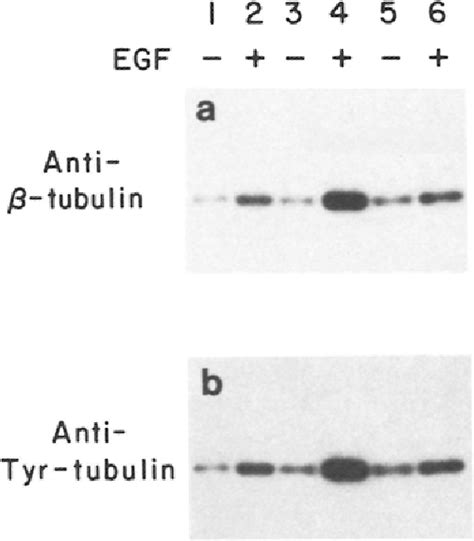 Figure 4 From Regulation Of Human Mesothelial Cell Differentiation