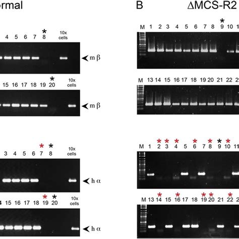 Single Cell Pcr Analysis In Humanised Erythroid Cells An Example Of α