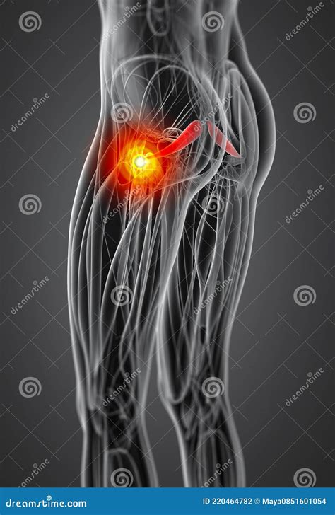 Medical Illustration Of The Piriformis Stock Illustration