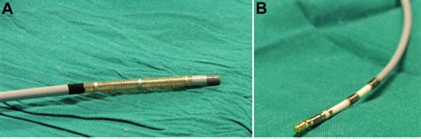 Remote Magnetic Navigation For Accurate Real Time Catheter Positioning And Ablation In Cardiac