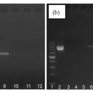 The comparison of GBS positive identification results by the culture ...