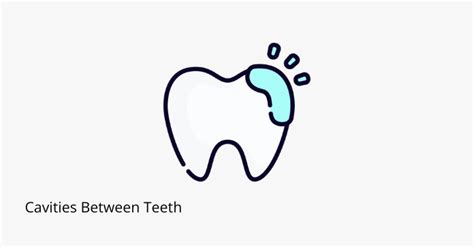 Cavities Between Teeth How To Spot Treat And Prevent Share Dental Care