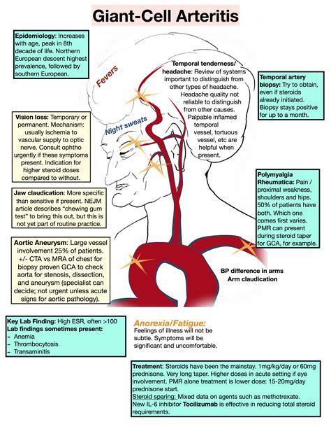 #61 Giant Cell Arteritis | Giant cell arteritis, Temporal arteritis, Polymyalgia rheumatica