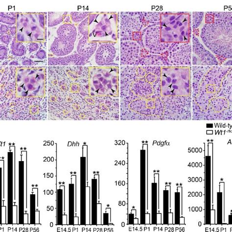 Sertoli Cell Specific Deletion Of Wilms Tumor 1 Wt1 In Wt1 Ϫ Flox