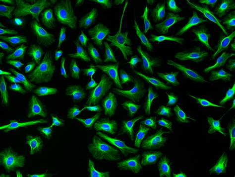 Ifluor Succinimidyl Ester Aat Bioquest