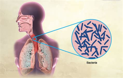 Health Condition Symptoms Causes Treatment And More