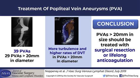 Treatment Of Popliteal Vein Aneurysms Journal Of Vascular Surgery