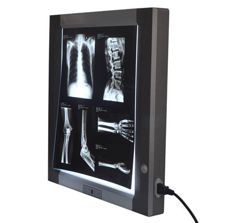 Buy LED X Ray Film Viewer Negato Xray View Box Illuminator Medical Film