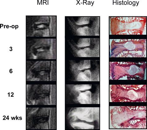 X Ray Findings Included Early Osteophyte Formation By 6 Weeks