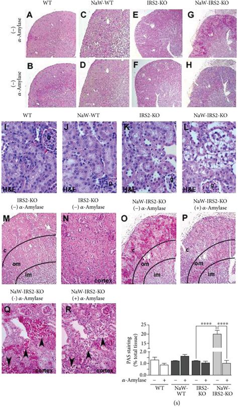 Naw Induces Glycogen Accumulation In Renal Cortical Tubules From